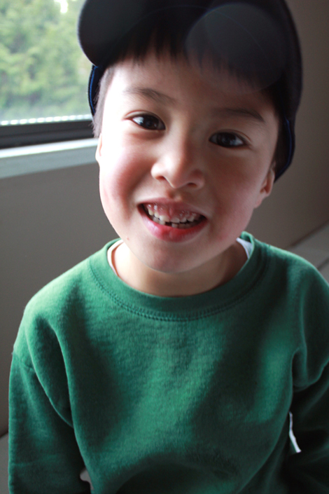 03122015 - First tooth
